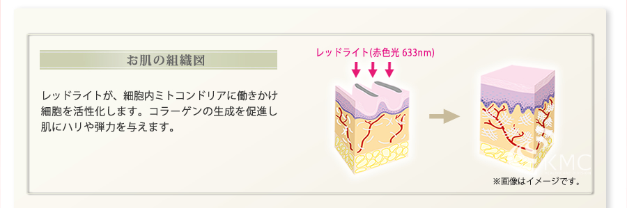 Baby’s Colla BELLA SCIC ベビーズコラ ベッラシック